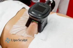 Are The Results From Aqualyx Permanent? 4 Compare Aqualyx Telford to other fat reduction treatments.