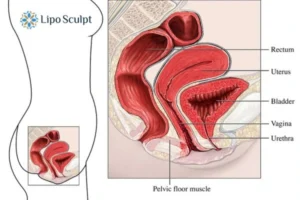 Treatment For A Leaky Bladder 2 How EM Chair treatment Telford can help Leaky bladder issues. Read more now!