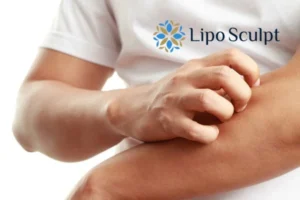 Best Actinic Keratoses Removal 4 prevent your actinic keratoses Telford getting worse - call our team today!