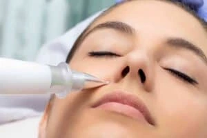 Best Actinic Keratoses Removal 3 Actinic keratoses Telford solutions - book in today!